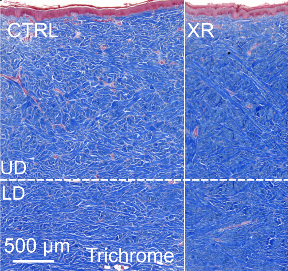tissue_exp_fibrosis.png